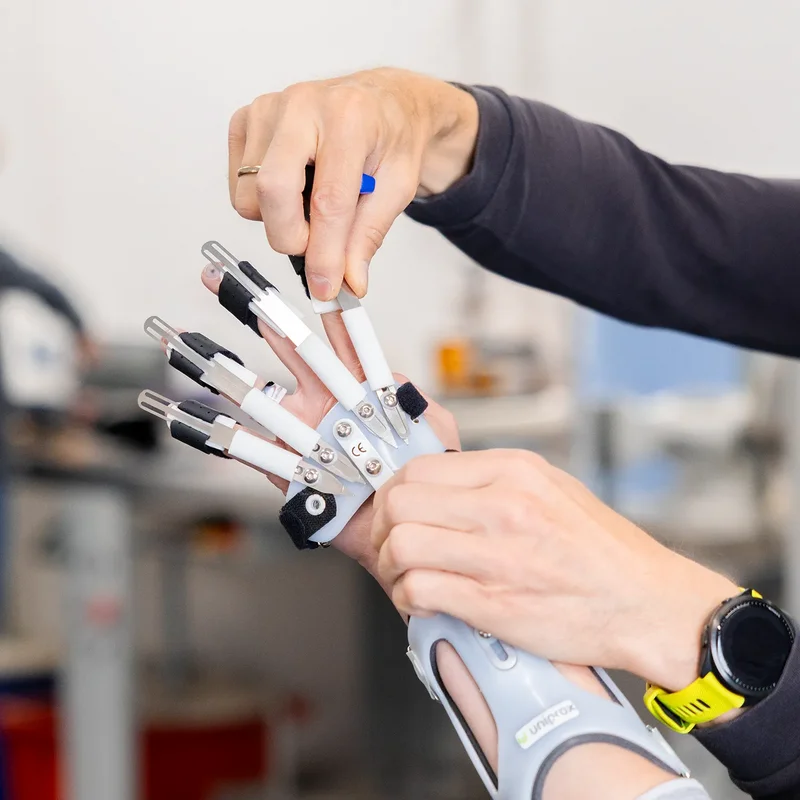 Anpassung einer DAHO Handorthese am Arm – präzise Einstellung für optimale Fingerbewegung und Greiffunktion
