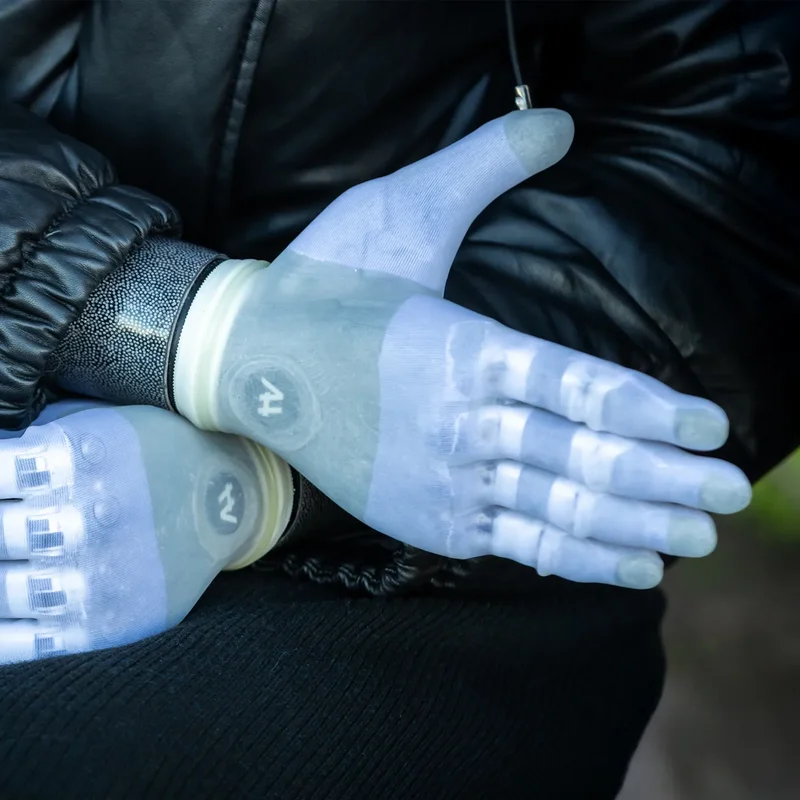 Person mit Adam Skin Handschuh über Handprothese – natürlicher Look und komfortable Integration im Alltag